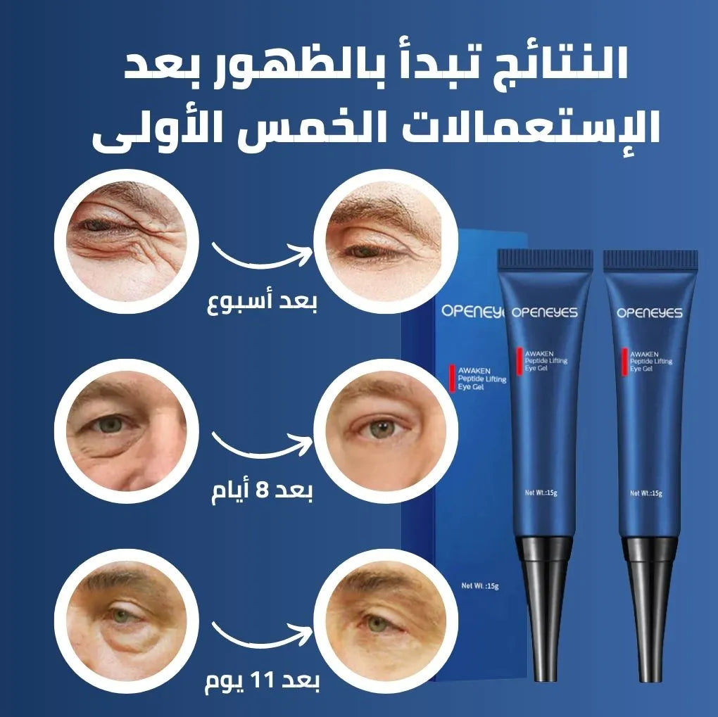 BrightenK™ كريم مزيل الهالات السوداء و أكياس العين