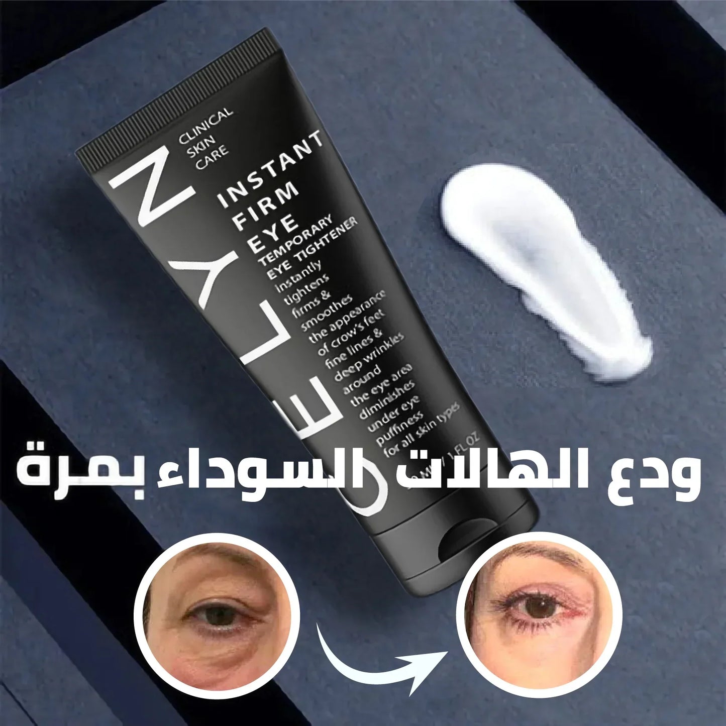 CELYN™ كريم مزيل الهالات السوداء و أكياس العين