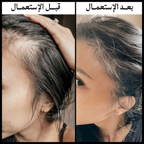 GLOPRO™ الديرما رولر الإلكتورنية المتطورة 3 في 1