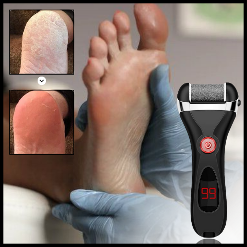 EXFOFEET™ الجهاز الإلكتروني لقدمين موردين كالعيال