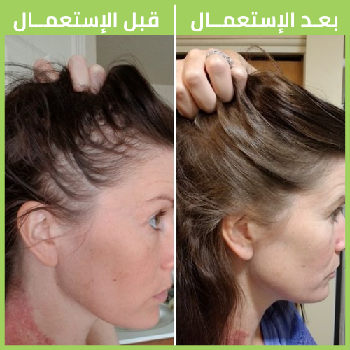 GINGERLUXE™ أخيرا الشامبوا اليباني الشهير في متجرنا