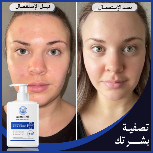 CLARDEN LOTION™ الغسول الشهير لبشرة موحدة وبتخبل