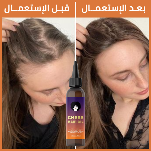 CHEBE™ زيت التشيبي الشهير لشعر كثيف وقوي
