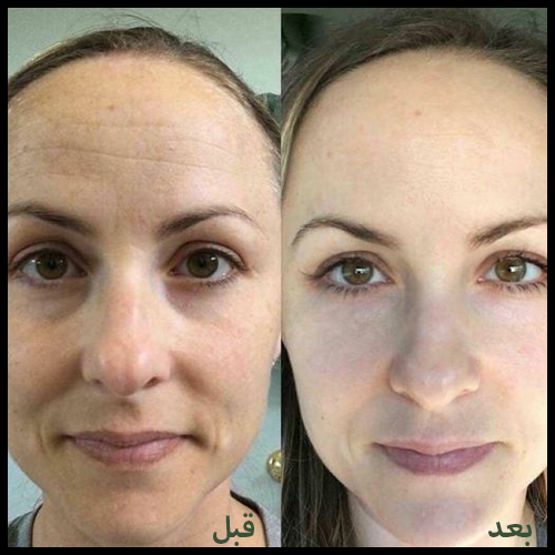 Eye Cream™ كريم العيون: الحل السحري لبشرة مثالية