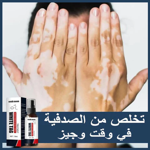FLWHITE TAG™ الحل الأخير للتخلص من الصدفية و البهاق