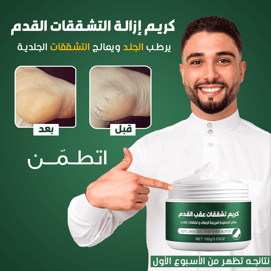 كريم كيرفر لإزالة تشققات القدمين للنساء ( كريم الترند 2023 )