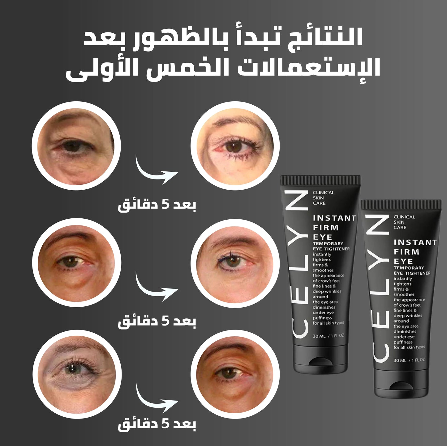 CELYN™ كريم مزيل الهالات السوداء و أكياس العين