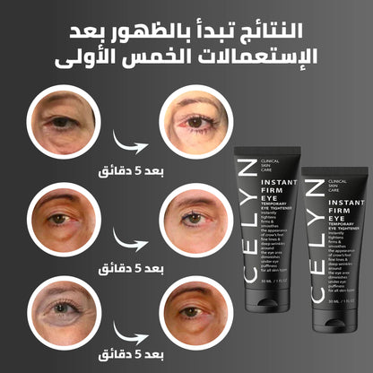 CELYN™ كريم مزيل الهالات السوداء و أكياس العين