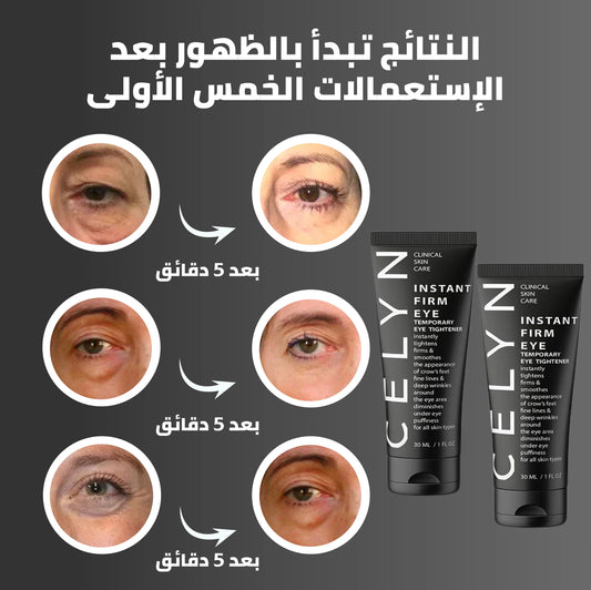 CELYN™ كريم مزيل الهالات السوداء و أكياس العين