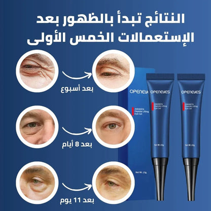BrightenD™ كريم مزيل الهالات السوداء و أكياس العين