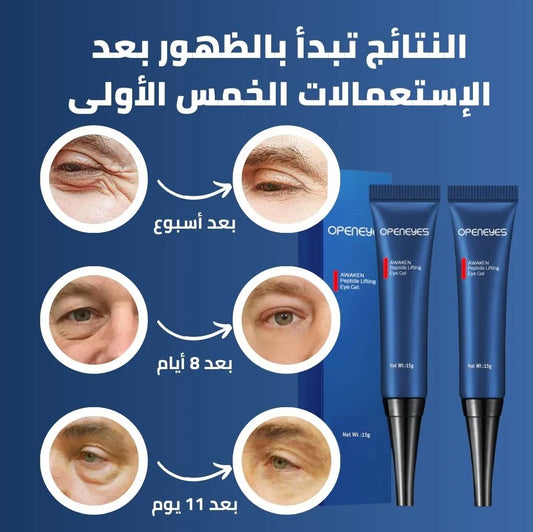 BrightenQ™ كريم مزيل الهالات السوداء و أكياس العين