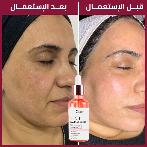 FACIAL SERUM™ السيروم الشهير لبشرة كالقمر 5 في 1
