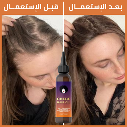 CHEBE™ زيت التشيبي الشهير لشعر كثيف وقوي