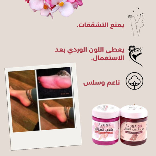 جل كعب الغزال