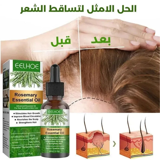 EELHOES ™ زيت إكليل الجبل للحد من تساقط الشعر
