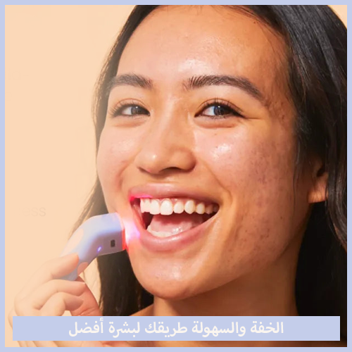 Acne Foe™ الحل السحري لحب الشباب!