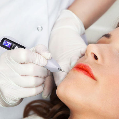 Laser Plasma Pen Skin Tag Remover