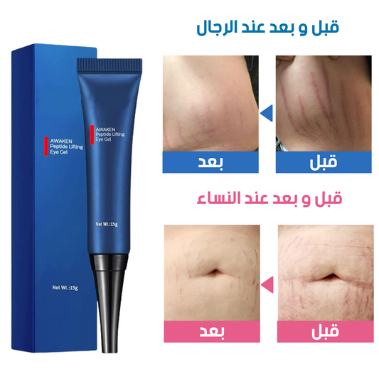 Brighten™ كريم مزيل تجاعيد البطن
