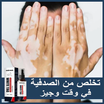 FLWHITE TAG™ الحل الأخير للتخلص من الصدفية و البهاق