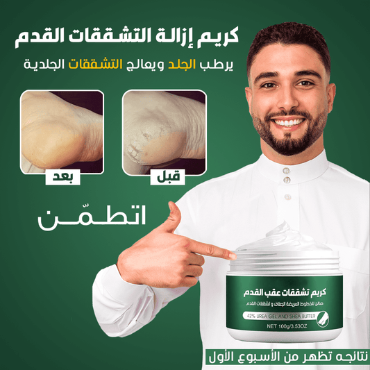 كريم كيرفر لإزالة تشققات القدمين للنساء ( كريم الترند 2023 )